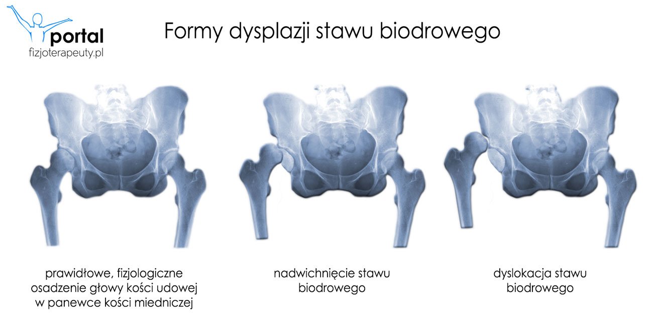 pieluchomajtki dla dorosłych xl